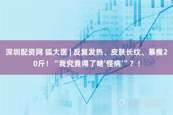 深圳配资网 狐大医 | 反复发热、皮肤长纹、暴瘦20斤！“我究竟得了啥‘怪病’”？！